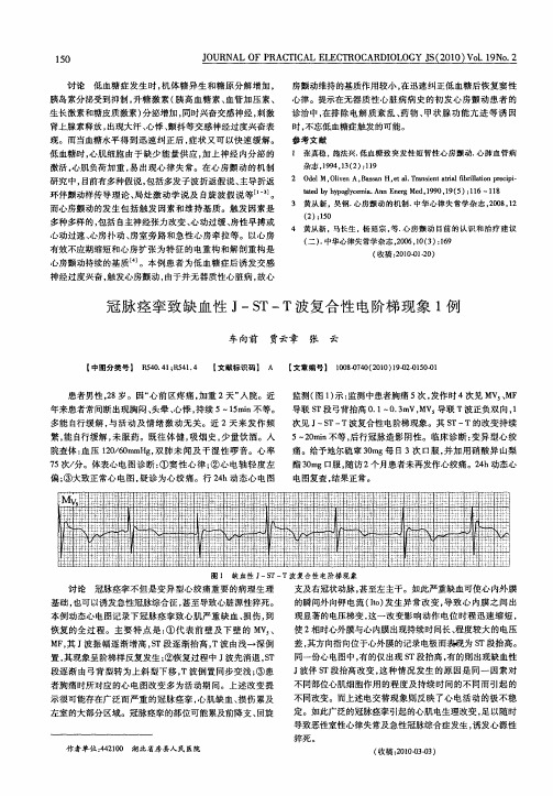 冠脉痉挛致缺血性J-ST-T波复合性电阶梯现象1例