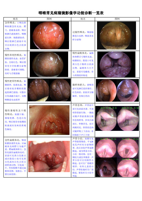 咽喉常见病窥镜影像学功能诊断一览表