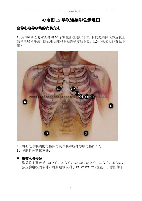 心电图12导联连接彩色示意图精编版