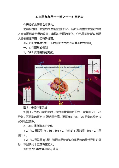 心电图九九八十一难之十一右室肥大