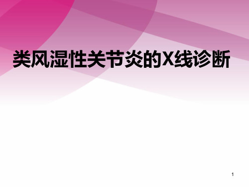 类风湿性关节炎的X线诊断PPT课件