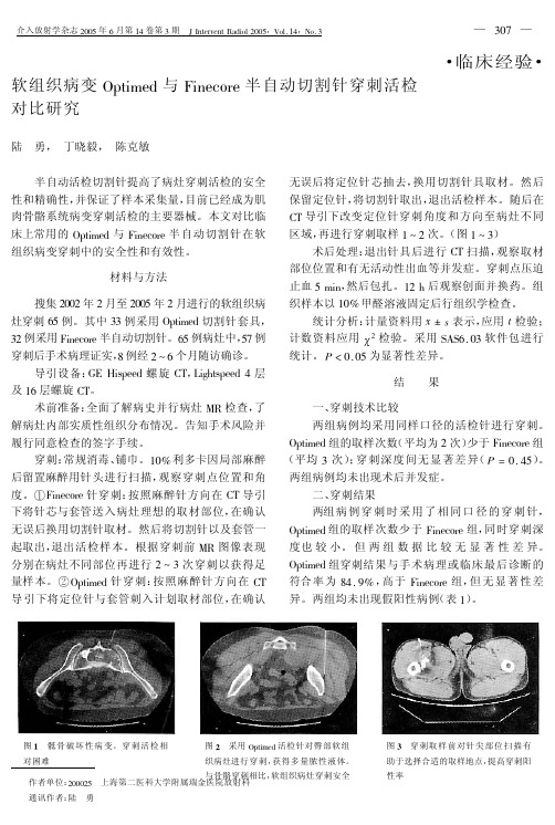 临床经验软组织病变Optimed与Finecore