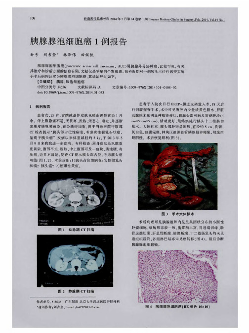 胰腺腺泡细胞癌1例报告