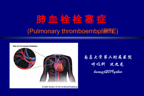 医学 内科学肺栓塞教案