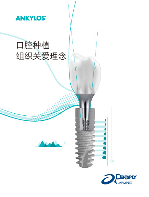 ANKYLOS系统介绍_组织关爱