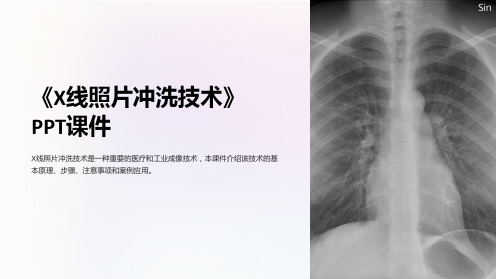 《X线照片冲洗技术》课件