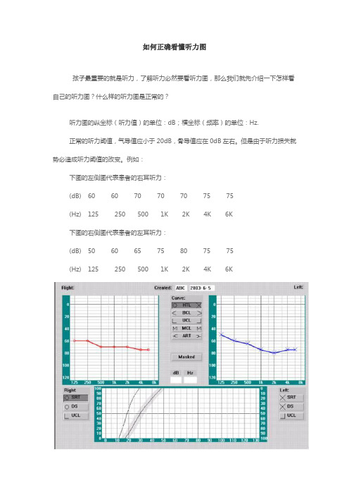 如何正确看懂听力图