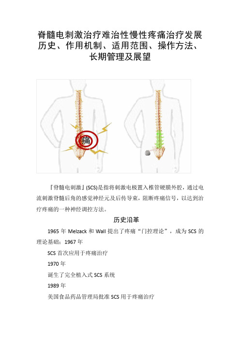 脊髓电刺激治疗难治性慢性疼痛治疗发展历史、作用机制、适用范围、操作方法、长期管理及展望