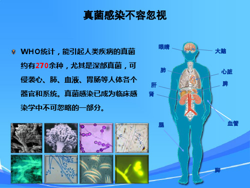 专科药物交流——伏立康唑