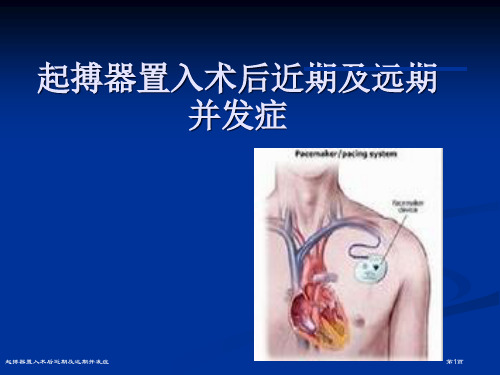 起搏器置入术后近期及远期并发症专家讲座