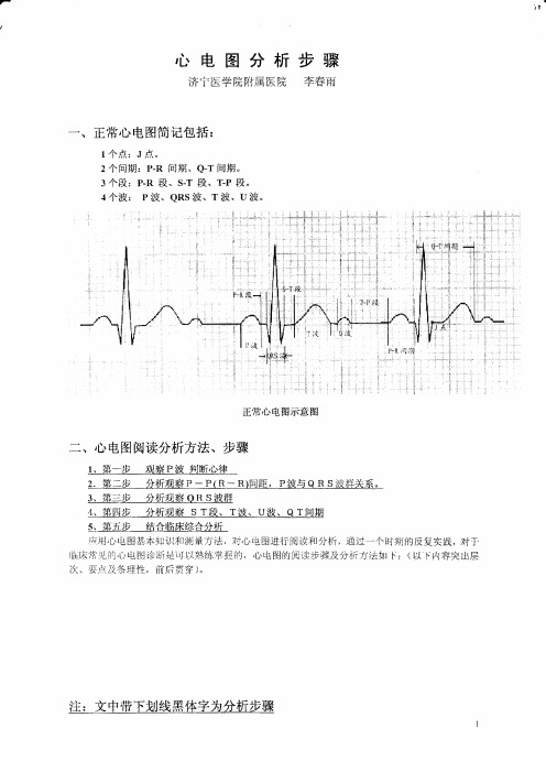 心电图分析步骤