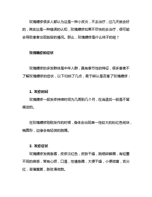 玫瑰糠疹发作时有哪些症状,怎么预防呢?