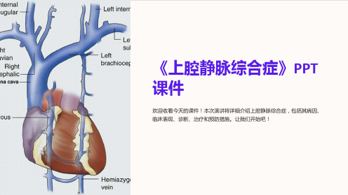 《上腔静脉综合症》课件