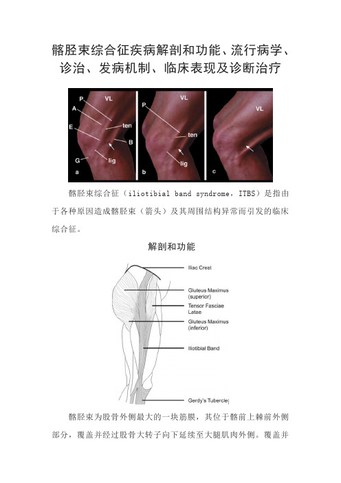 髂胫束综合征疾病解剖和功能、流行病学、诊治、发病机制、临床表现及诊断治疗