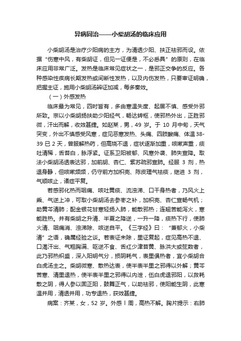 异病同治——小柴胡汤的临床应用