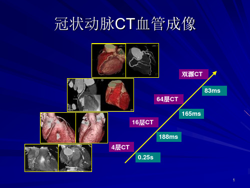 双源CT及其临床应用ppt课件