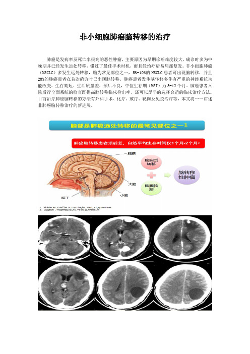 非小细胞肺癌脑转移的治疗