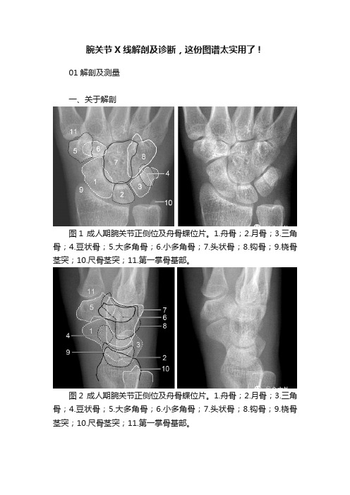 腕关节X线解剖及诊断，这份图谱太实用了！