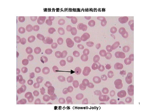 (精选课件)血涂片图谱