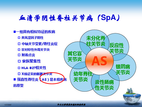 SpA骶髂关节炎的影像学诊断与鉴别诊断