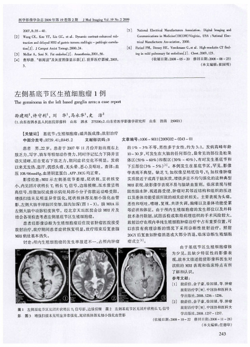 左侧基底节区生殖细胞瘤1例