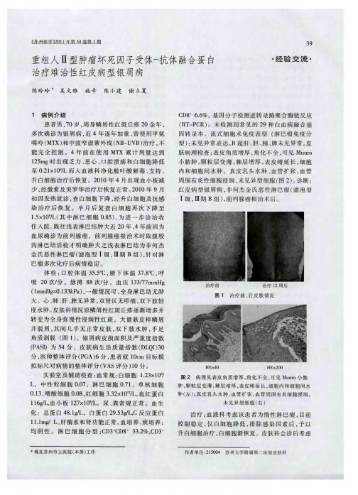 重组人Ⅱ型肿瘤坏死因子受体-抗体融合蛋白治疗难治性红皮病型银屑病