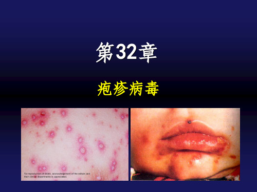 医学微生物第32章疱疹病毒