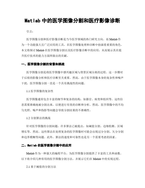 Matlab中的医学图像分割和医疗影像诊断