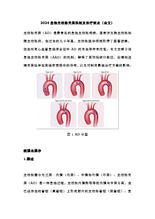 2024急性主动脉夹层机制及治疗要点(全文)