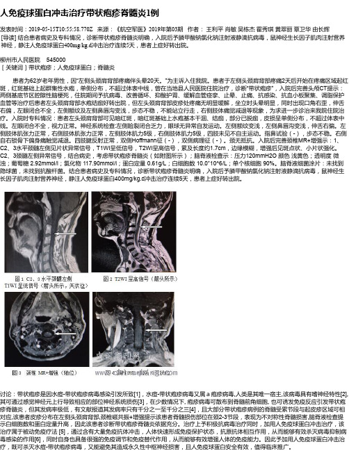 人免疫球蛋白冲击治疗带状疱疹脊髓炎1例