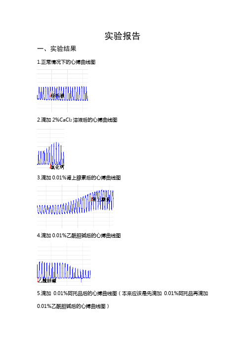 蛙心灌流实验