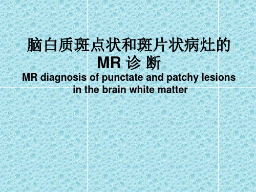 脑白质斑点状和斑片状病灶的MR 诊 断