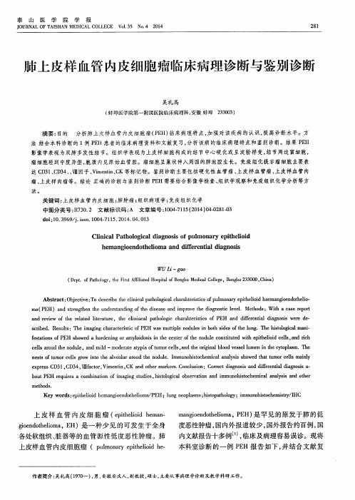 肺上皮样血管内皮细胞瘤临床病理诊断与鉴别诊断