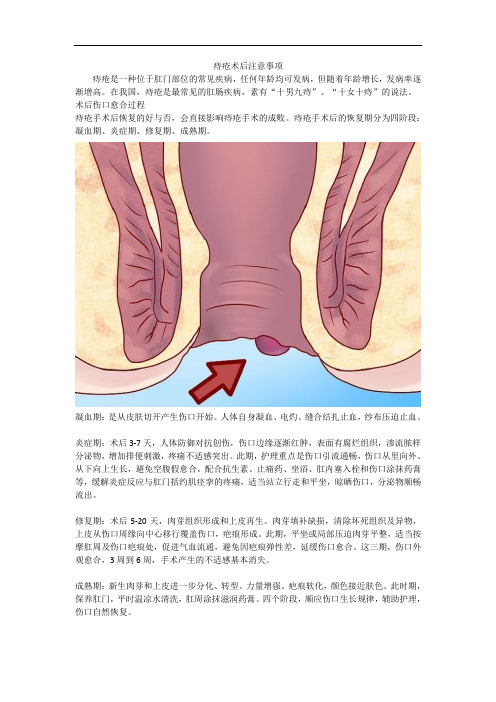 痔疮术后注意事项.(肛部促愈垫)docx - 副本