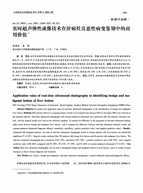 实时超声弹性成像技术在肝病灶良恶性病变鉴别中的应用价值