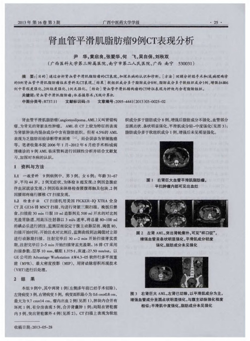 肾血管平滑肌脂肪瘤9例CT表现分析