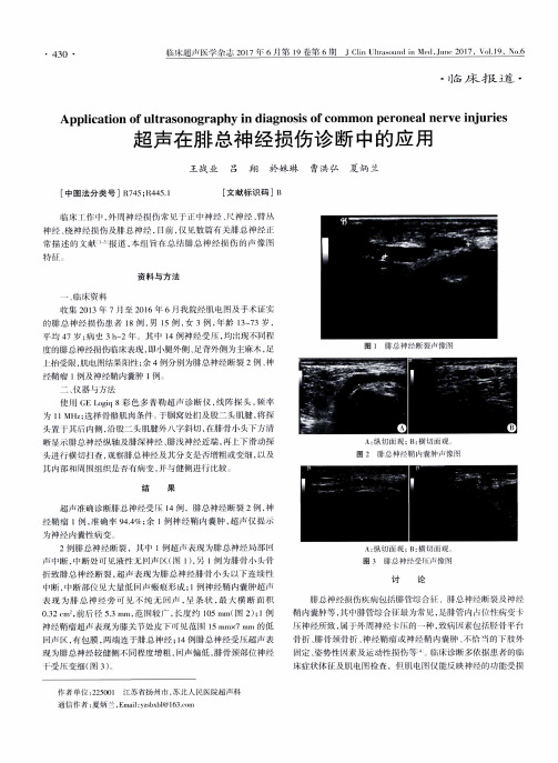 超声在腓总神经损伤诊断中的应用