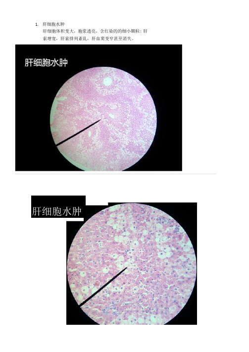 病理学镜下切片