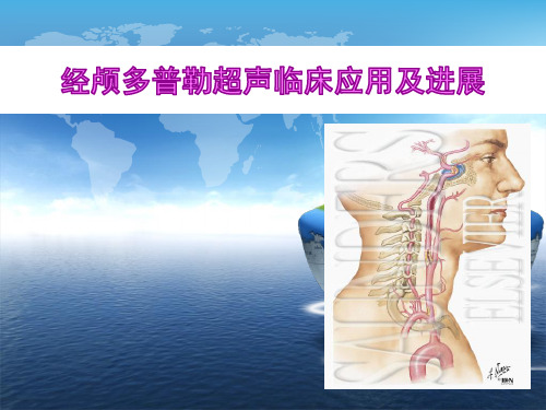 经颅多普勒超声