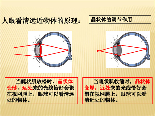 近视眼与远视眼的成因及矫正