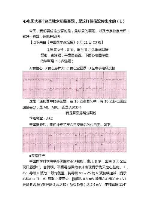 心电图大赛│这些独家珍藏赛题，是这样偷偷流传出来的（1）