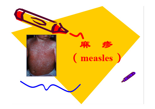 儿科学课件-麻疹