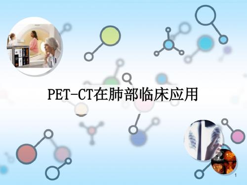 肺部肿瘤PET-CT检查医学PPT课件