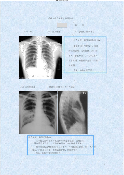 肺部诊断报告