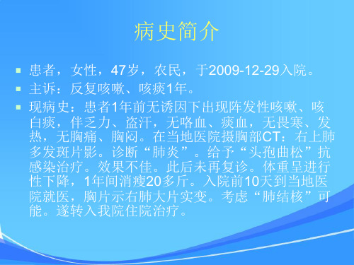 淋巴瘤误诊为肺结核病例分析