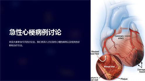 急性心梗病例讨论课件