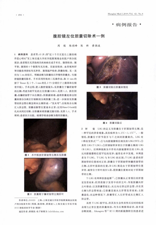 腹腔镜左位胆囊切除术一例