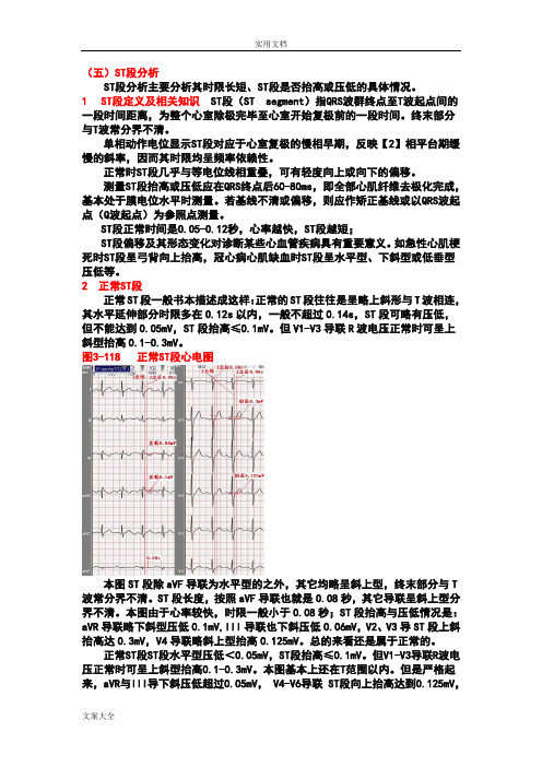 另类心电图学讲义9--ST段分析报告