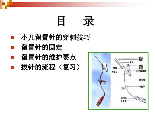 小儿留置针的穿刺技巧固定与维护