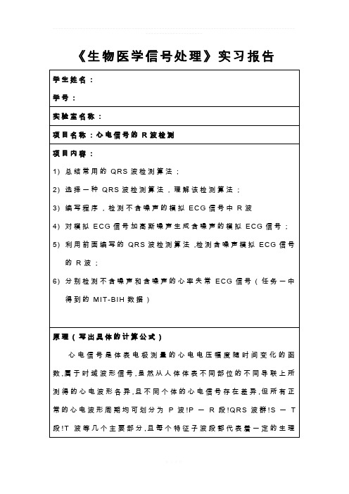 matlab心电信号R波检测